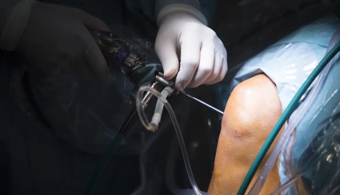 Laparoscopic Ovarian Cystectomy